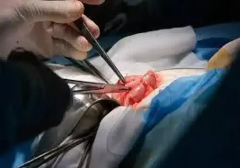 Gastro Surgery