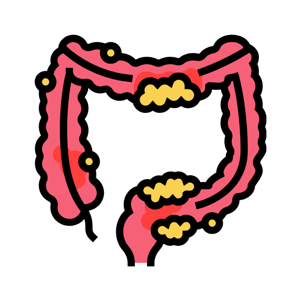 Crohn’s Disease