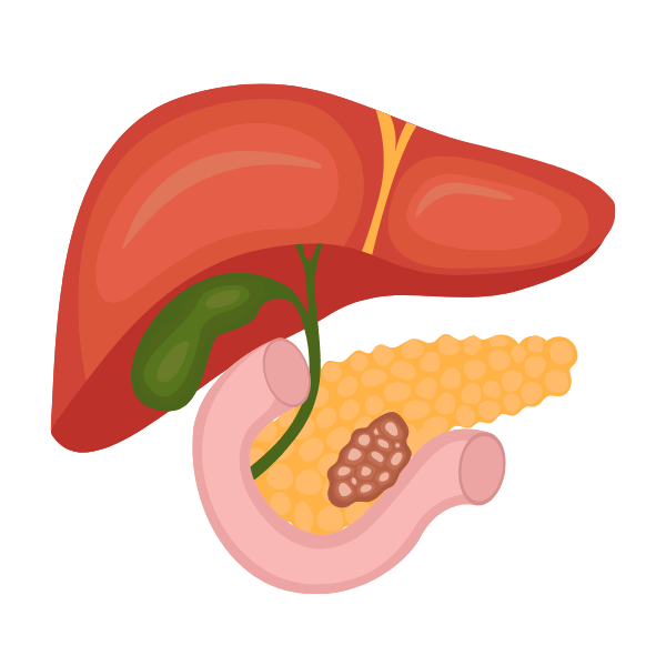 Pancreatic Cancer 1