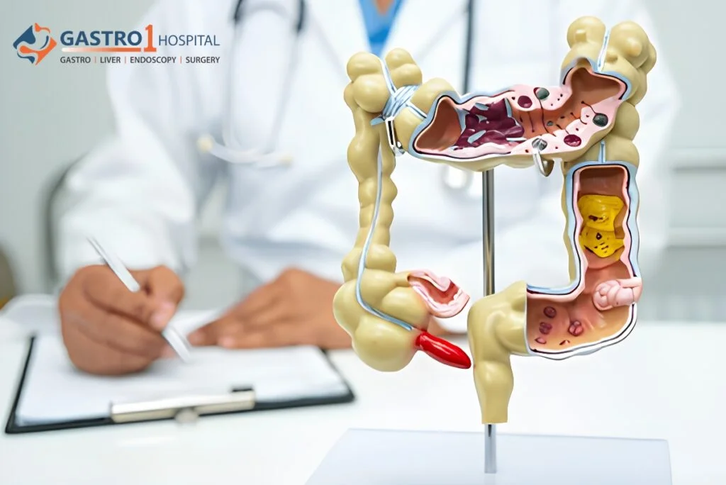 Person holding lower right abdomen experiencing acute appendicitis pain symptoms