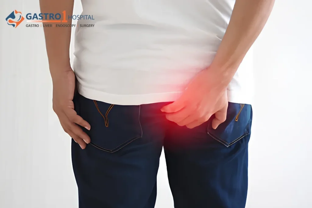 internal external and thrombosed piles symptoms