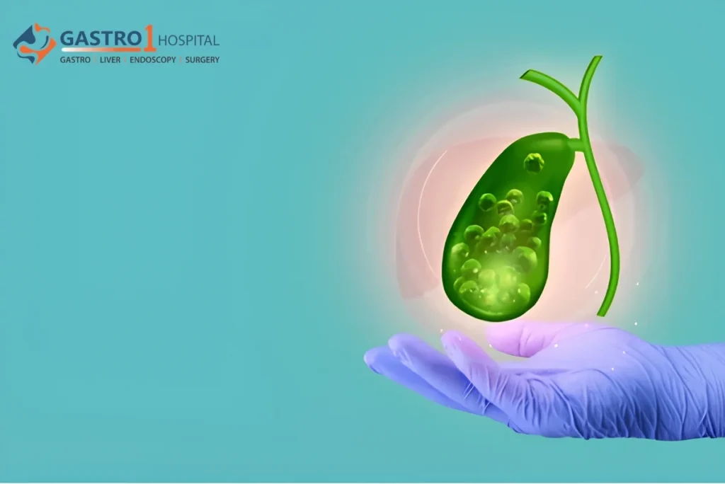 Healthy high fiber foods safe to eat after a gallbladder stone diagnosis