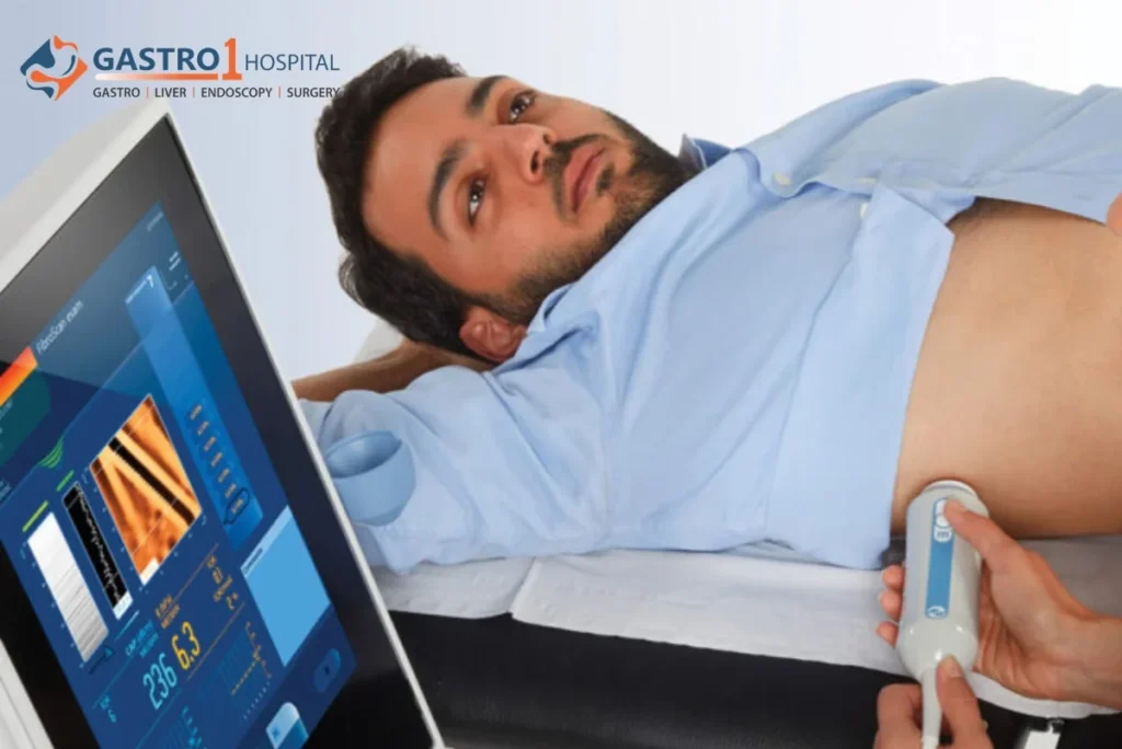 Medical specialist performing a non-invasive Fibroscan ultrasound test to check liver stiffness
