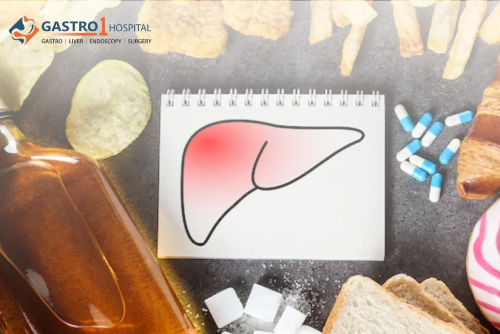 Fried greasy fast food snacks presenting a metabolic risk to liver health