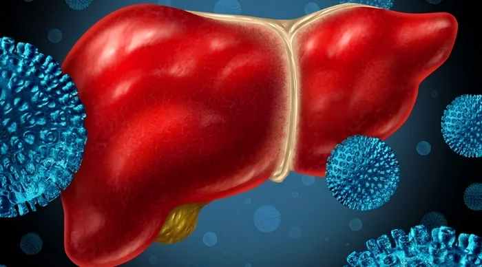 Hepatitis