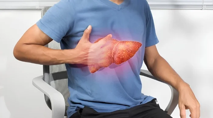 Liver Cirrhosis