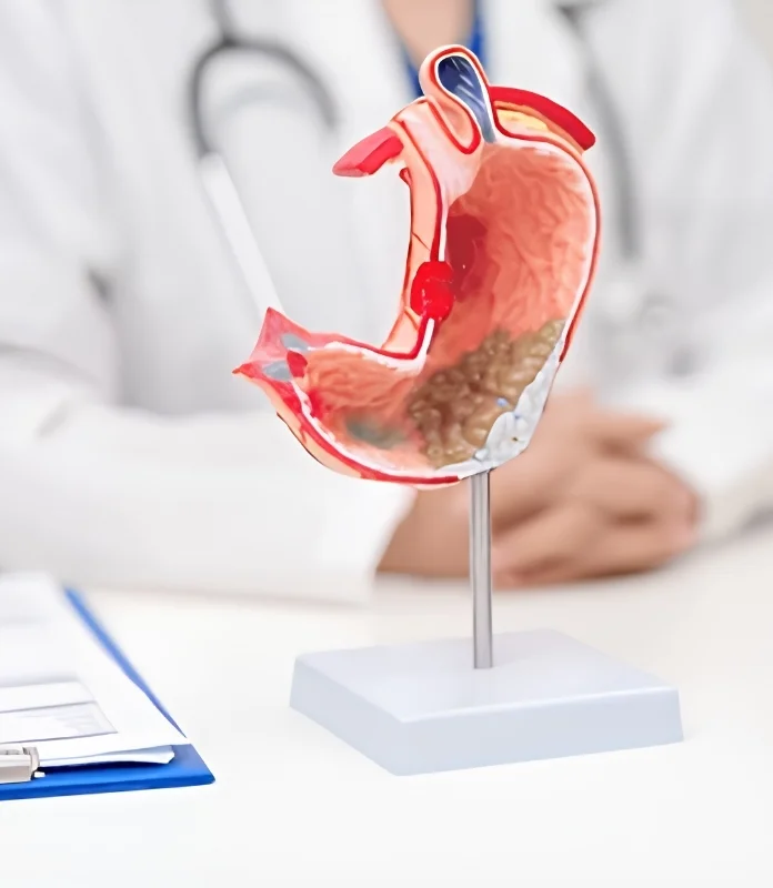 Gastroenterologist Treatment