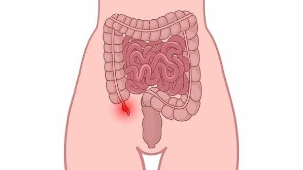 Appendix